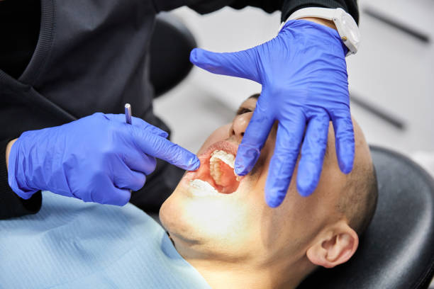 Best Emergency Wisdom Tooth Extraction in Oakland, FL